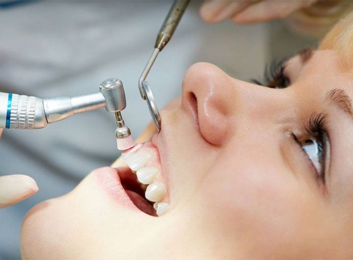 Precíz fogágybetegség kezelés